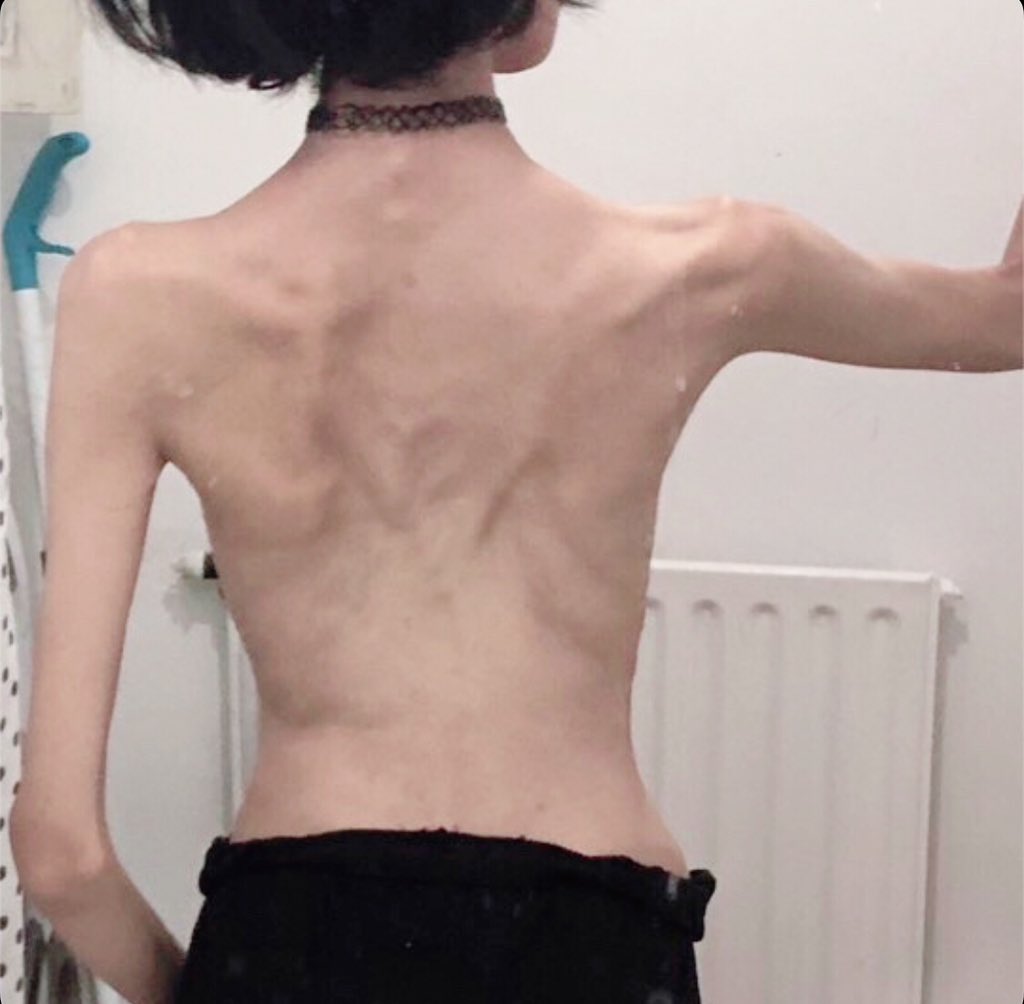 uniwonylove's tweet photo. bc 
all i want is a single digit bmi more than anything in the world https://t.co/xzMscy5dlH