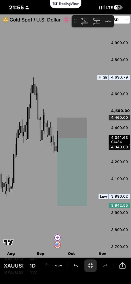 name_unclear's tweet photo. Trade Idea on #XAUUSD
TP or SL
#SetandForget
#viral
#Forex https://t.co/J6GRJZNY9h