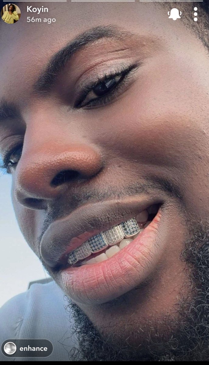 FAsochukwu605's tweet photo. Lips  check ✅️
Teeth check ✅️
Nose check ✅️
Face check  ✅️
Eyes pretty 😍 https://t.co/HyTmgAs6TX