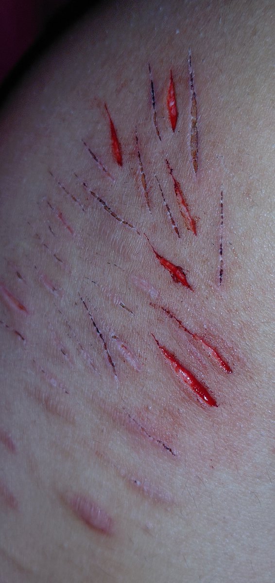 alyissdeaad's tweet photo. i am in heaven.. minibeans or smt heh also those r my scabs from the previous post ig... ALL FAKE SFX MAKEUP #ouchietwt #shrtwt https://t.co/1gYqmrq9Tt