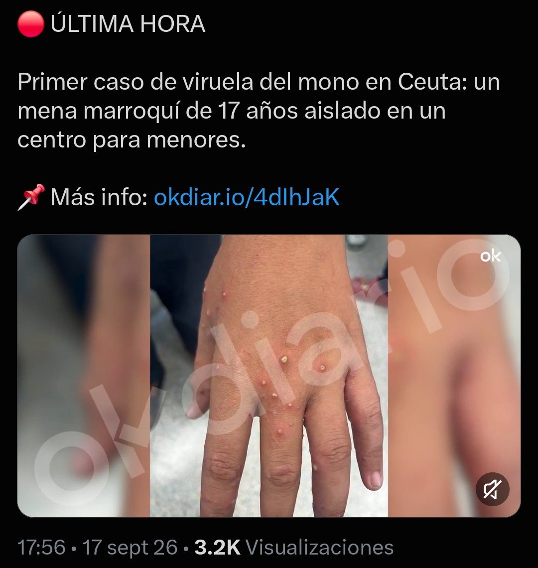 JohnGJordan219's tweet photo. @sanchezcastejon Primer caso de viruela del mono en Ceuta traída por los invasores que dejaste entrar y que no expulsas. Ahora tu ineptitud puede generar una pandemia. Bien Pedro, seguí acumulando delitos para juzgarte cuando pierdas el poder jaja. https://t.co/9xcXjpNfAf