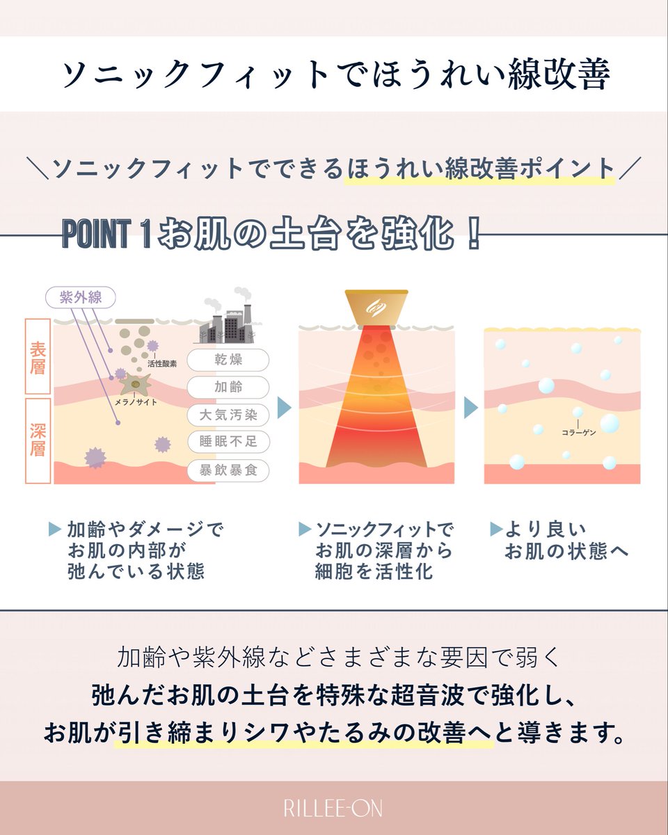 rillee_on's tweet photo. 🪞 40代 ほうれい線改善

Before → After でこのように変化✨️

◾︎口横のもたつき
→リフトアップし、スッキリ！

◾︎顏幅
→余分な脂肪が減少し、顔幅がひと回り小さく

◾︎頬
→トップの位置が上がり、引き締まった印象に

#リリーオン #ソニックフィット 
#ほうれい線 https://t.co/a0w0IMZyrE