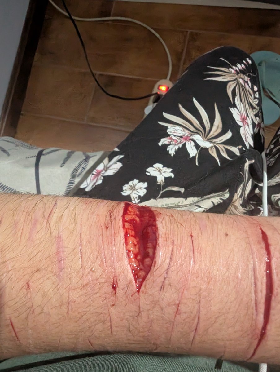 xX_Di4ny_Xx's tweet photo. Posting this SFX MAKEUP i made
All fake https://t.co/37KkO0aJ7Z