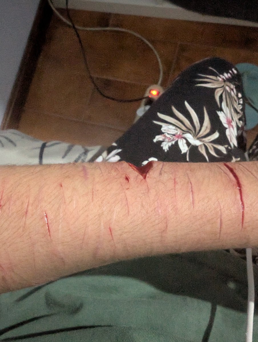 xX_Di4ny_Xx's tweet photo. Posting this SFX MAKEUP i made
All fake https://t.co/37KkO0aJ7Z