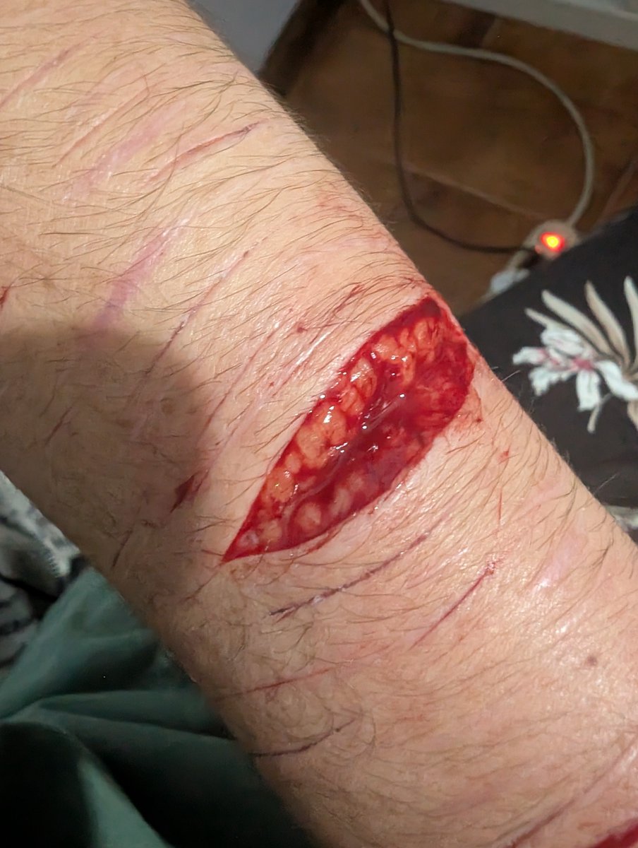 xX_Di4ny_Xx's tweet photo. Posting this SFX MAKEUP i made
All fake https://t.co/37KkO0aJ7Z