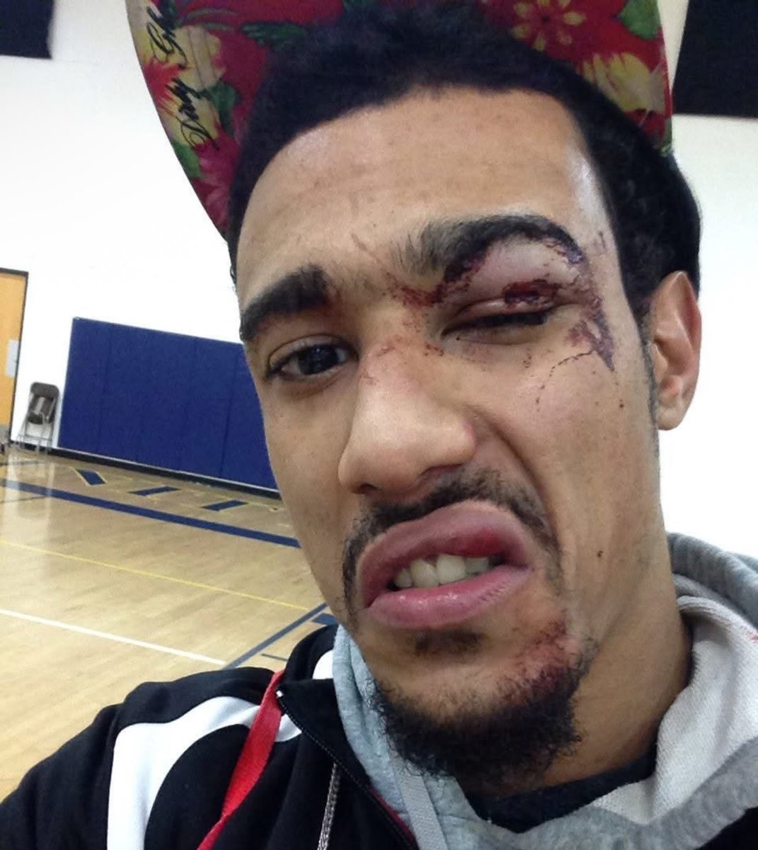 ARealFoxx's tweet photo. 12 YEARS AGO I GOT ROCKED IN A MATCH #THROWBACK #ARFOX https://t.co/p7CSSFUj1b