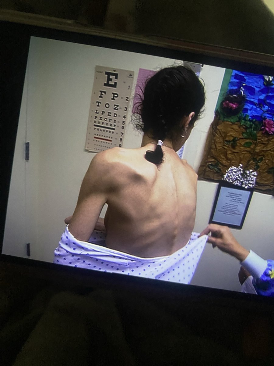 imnotRuby_xX's tweet photo. Mutis acabo de ver este documental sobre chicas anoréxicas esta muy entretenido se los recomiendo #edrtwtㅤ #ed https://t.co/GPcTcmvJVF