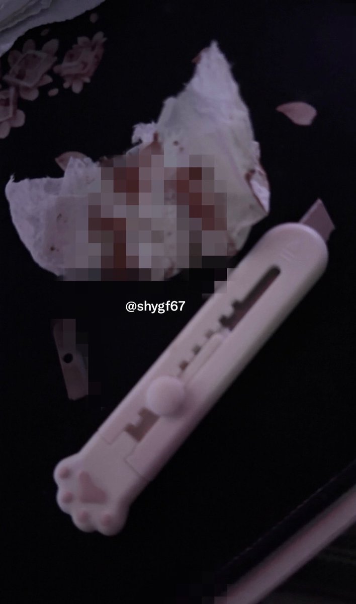 shygf67's tweet photo. fake blood, sfx makeup :p https://t.co/hSOrDhXJc8