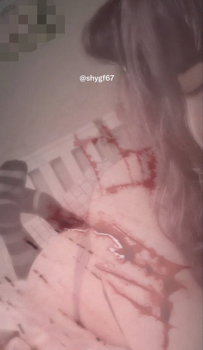shygf67's tweet photo. fake blood, sfx makeup :p https://t.co/hSOrDhXJc8