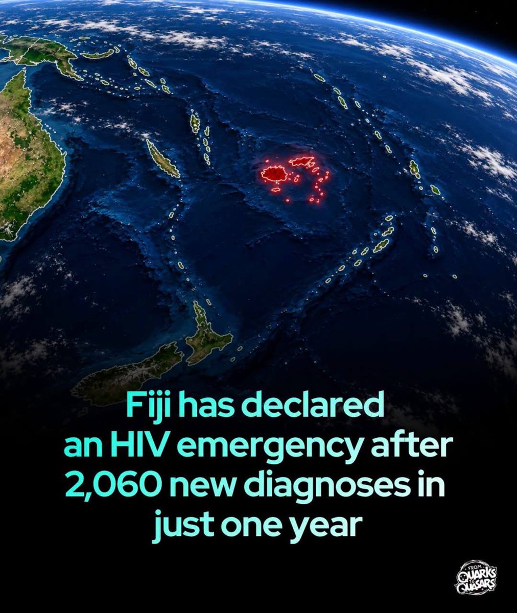 PaulGoldEagle's tweet photo. This is due to the COVID vaccine. 💉
Remember that many Drs warned us that the vaccine causes V-AIDS?!!!!!!!!
They knew it causes vaccine induced AIDS…so how to get one over on the public so they never suspect the vaccine?
Hey guys.
There’s an “HIV” breakout. 🥴
You know just like they added HIV to the polio vaccine and that’s how it spread.
ALL viruses are man made.
God did not create a single one.
This was going on in Genesis btw. The fallen angels were the ones to start this mess. The elites just took it over.