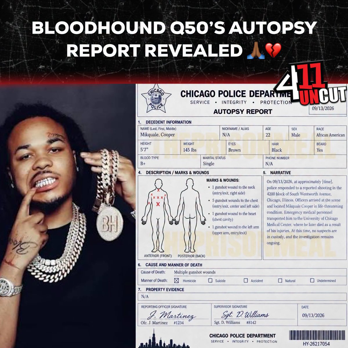NewAgeMediaPod's tweet photo. Known Rapper BloodHound Q50 Autopsy Has Been Revealed, Out Of 80-100 Shots Q50 Have Seem To Been Shot 8 Times
1 GunShot Wound To The Neck
5 GunShot Wounds To Chest
1 GunShot Wound To The Heart
1 GunShot Wound To The Left Arm
#RIPQ50๐๐พ๐๏ธ https://t.co/uDnUWLp3hJ
