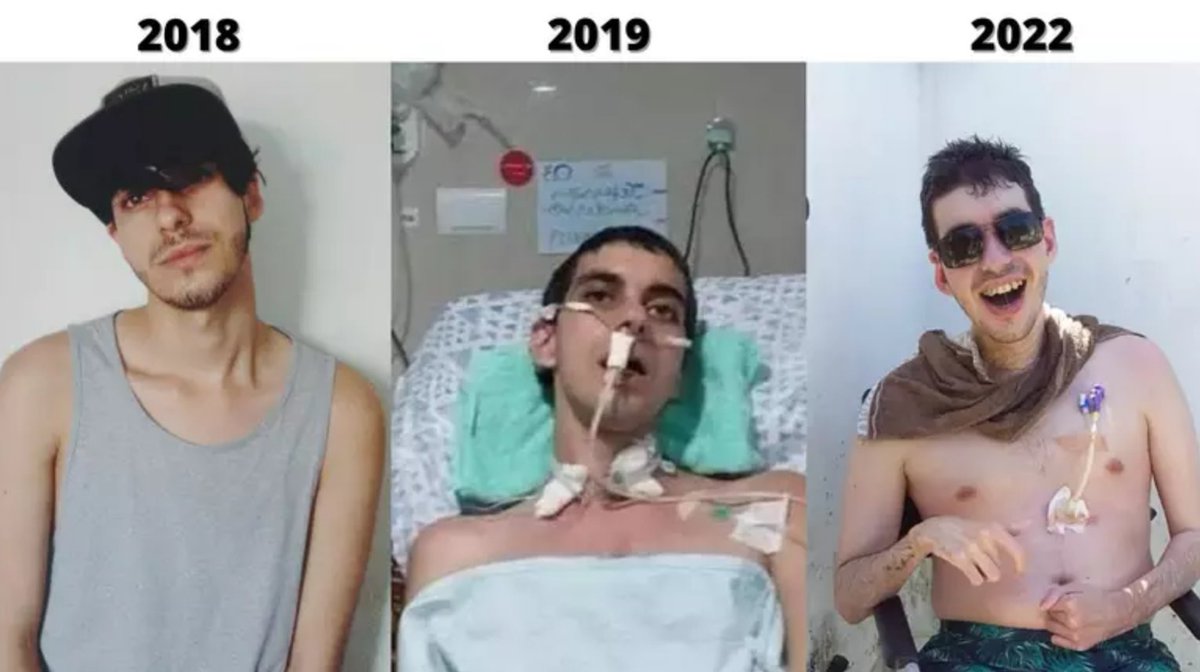 SiteJamesons's tweet photo. Em 2018, o Jefferson Anderson Feijó da Cruz foi espancado e abusado em uma festa. Ficou em coma, cheio de sequelas.

Ele estava comemorando a aprovação no vestibular. E sua vida foi arruinada por um crime de ódio.

A mesma homofobia que é usada de palanque pela Família Bolsonaro. https://t.co/4NRJ7s4YwR