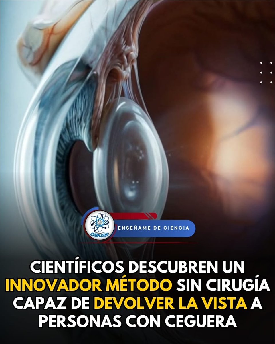 EnsedeCiencia's tweet photo. 🚨Científicos descubren un método con el cual será posible devolver la vista a miles de personas con ceguera que han sido afectadas por enfermedades degenerativas. Se trata de la regeneración de retina, lo que ayudaría a las personas a recuperar la vista. https://t.co/Pr8wdf1szi