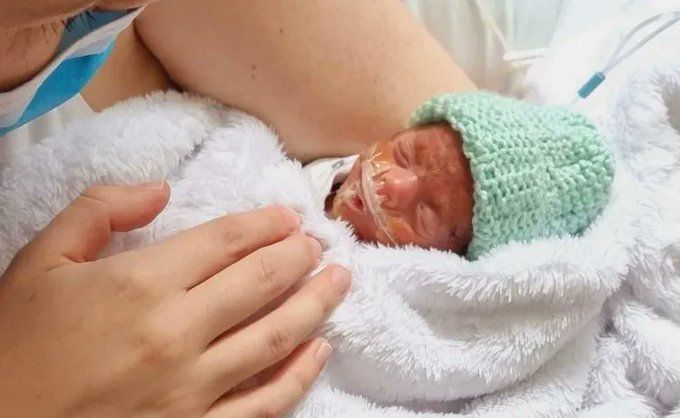 LifeNewsHQ's tweet photo. Here's a baby born 16 weeks early.

Three measures this November would allowing killing babies like this in an abortion by legalizing abortions UP TO BIRTH.

Question 1 in Virginia
Proposition 1 in idaho
Amendment 6 in Nevada

Vote NO! https://t.co/Wc9bs4IkbA