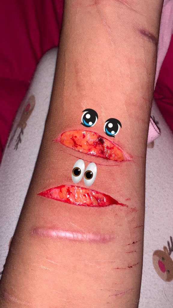 5erjf's tweet photo. #sfxmakeup #fakeblood #artistmakeup https://t.co/fBuKMC9gQG