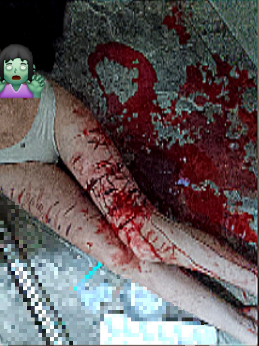 sadorexika's tweet photo. SFX MAKEUP FAKE BLOOD! FAKE ALL FAKE ALL 
#shtwt #shedtwt #SFXMAKEUP #ouchietwt https://t.co/dM6BR563QS