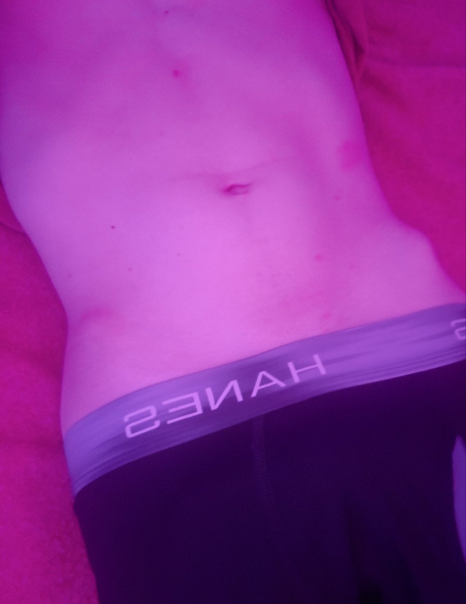 fembeams's tweet photo. Tummy! https://t.co/HK8a73fz2V