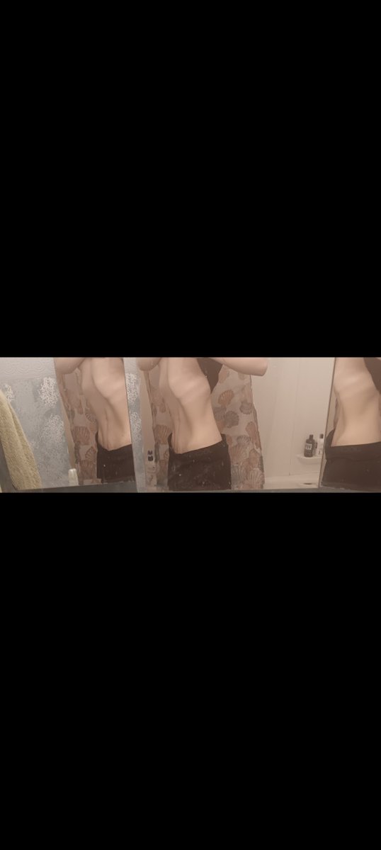 wrecksix4r4's tweet photo. 53 BMI -> 23 BMI sucking in (in the before AND after 💀)
#wlspo #edrtwt #4n4 #🦋 #highsw #wlprogress https://t.co/aG4uJ0HmRp