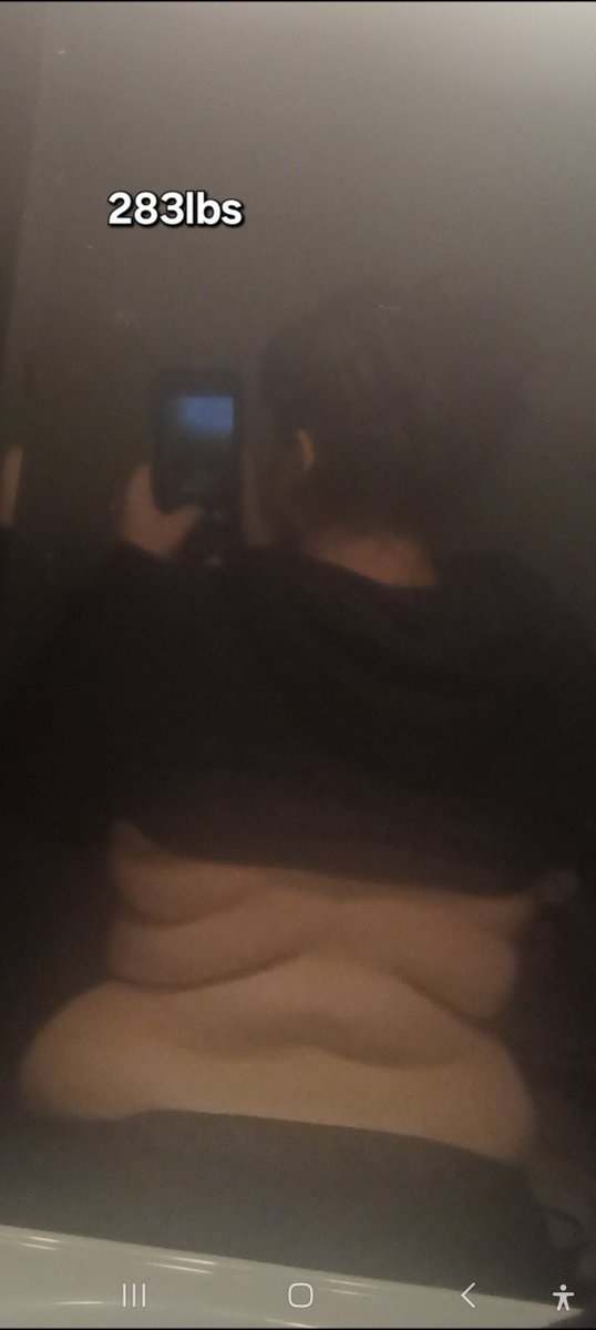 wrecksix4r4's tweet photo. 53 BMI -> 23 BMI sucking in (in the before AND after 💀)
#wlspo #edrtwt #4n4 #🦋 #highsw #wlprogress https://t.co/aG4uJ0HmRp