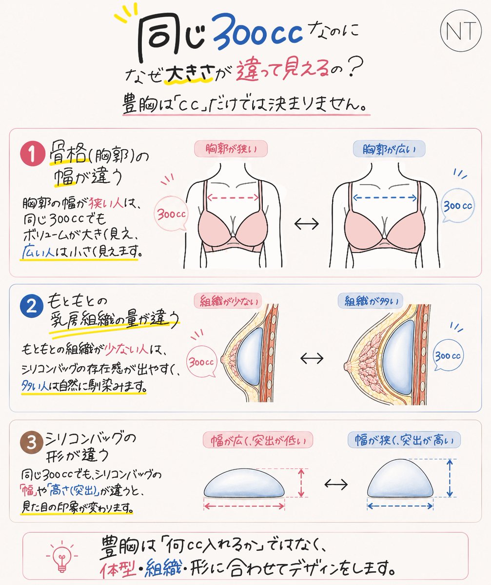 notejp_arte's tweet photo. 『 同じ㏄なのにサイズが違う理由 』

豊胸の仕上がりは、単純に
「どれだけ大きくするか」
だけで決まるものではありません。

同じ300ccのシリコンバッグでも

・胸郭の幅
・もともとの乳腺・皮下組織の量
・シリコンバッグの形状

によって、見た目のボリュームや
バストラインの印象は大きく変わります。

また、乳腺や皮下組織が少ない方は
シリコンバッグの輪郭や存在感が出やすく
組織量が十分にある方は
より自然に馴染みやすい傾向があります。

そのため豊胸では
「何cc入れるか」だけではなく

ご自身の体型に合ったシリコンバッグの幅や形
理想とするバストライン
そして現在の乳房組織との馴染み方まで考慮し
一人ひとりに合わせてデザインすることが大切です。

Arte 症例写真：https://t.co/Oi5mPV139s
Arte 公式LINE：https://t.co/eyYU3xIlhw 
#ノート美容外科アルテ #アルテ #豊胸手術 #ノート美容外科