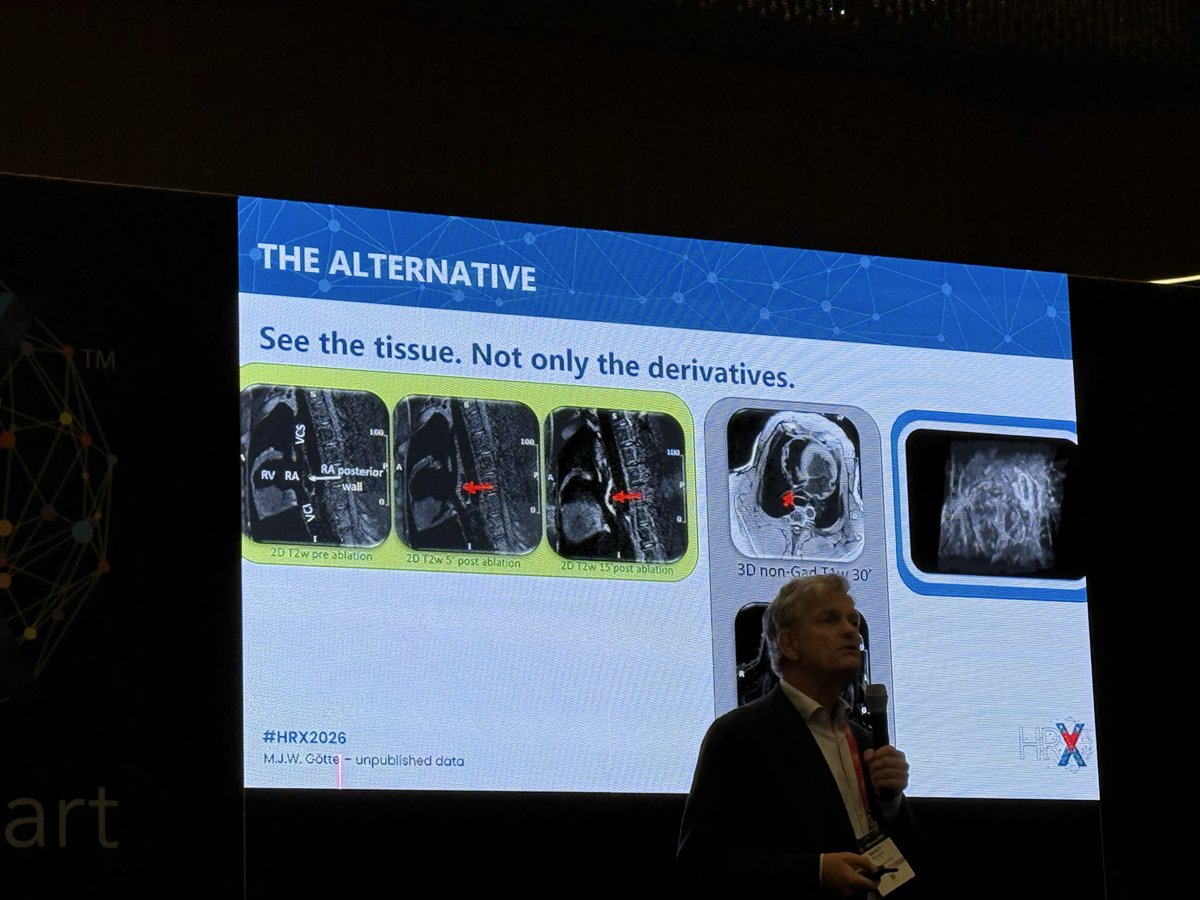 iamritu's tweet photo. #WhyCMR guided #ablations #HRX2026
#imaging https://t.co/EWLluqsLjT real-time MR guidance VISABL-VT trial will clarify clinical utility & long-term outcomes reliable coregistration b/w MRI-derived scar LGE & intracardiac mapping enables substrate-guided ablation https://t.co/RF4FsiLAaU