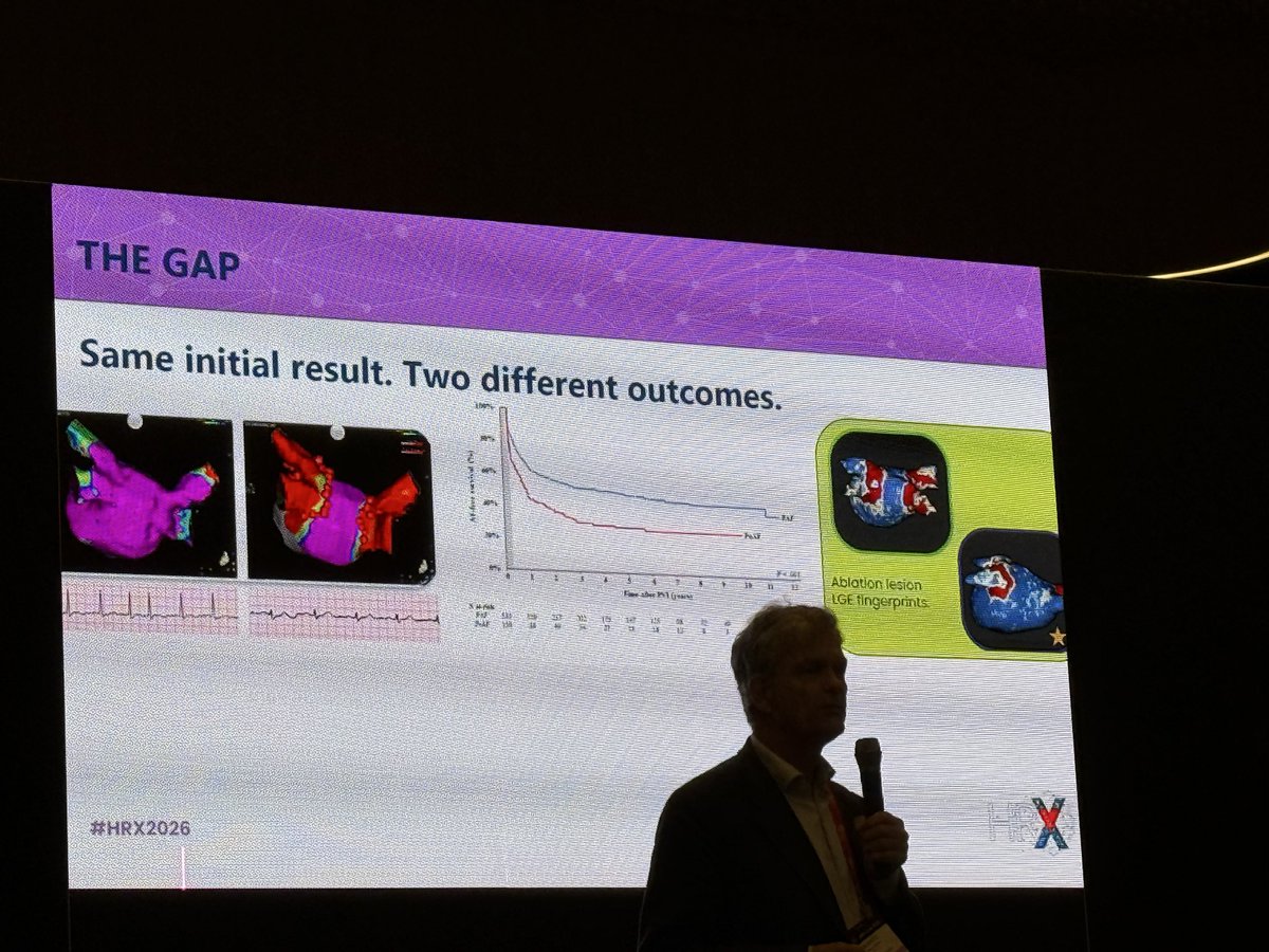 iamritu's tweet photo. #WhyCMR guided #ablations #HRX2026
#imaging https://t.co/EWLluqsLjT real-time MR guidance VISABL-VT trial will clarify clinical utility & long-term outcomes reliable coregistration b/w MRI-derived scar LGE & intracardiac mapping enables substrate-guided ablation https://t.co/RF4FsiLAaU