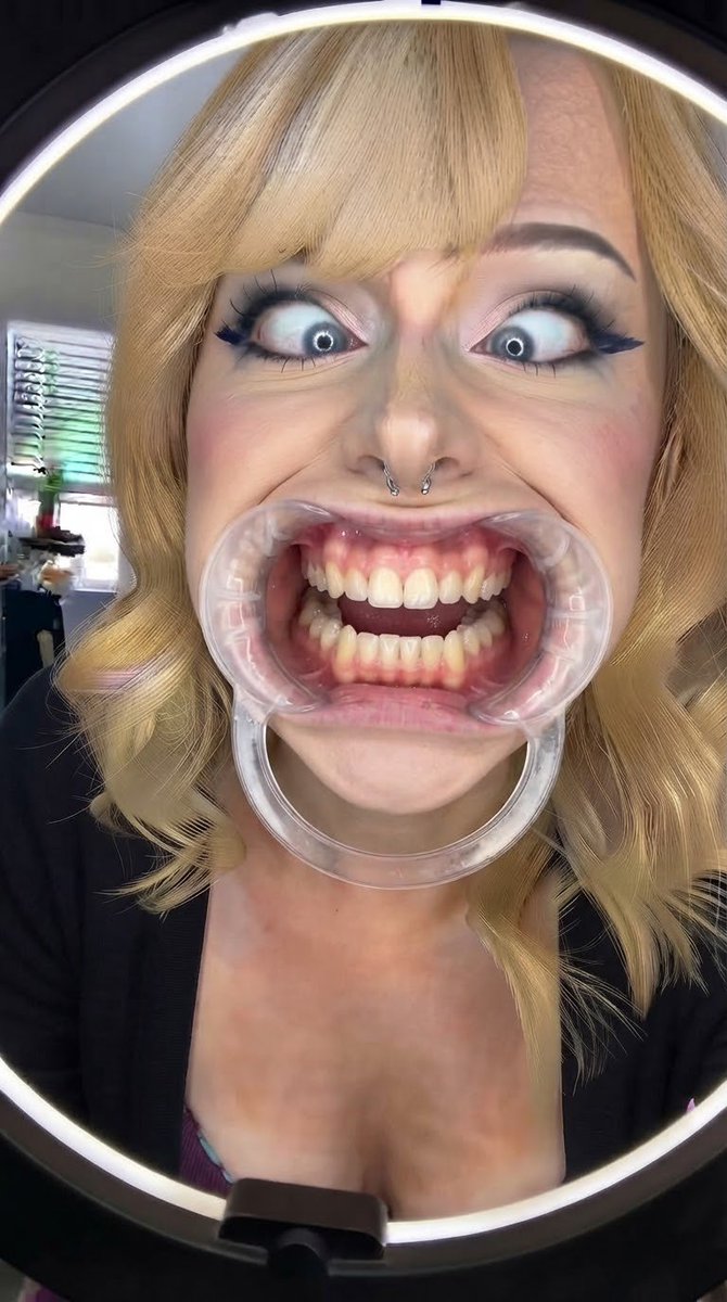 mugiwarano0403's tweet photo. DM open, send me faces you want to turn into a mess.

#sillyface #faceporn #ahegao #speculum #bigmouth #mouth #mouthfetish #longtongue #tongue #tonguefetish #foodplay #chocolate #spit #saliva #drool #spitplay #teeth #goon #degraded #crossedeyes #crosseyed #goon https://t.co/u2q4cO8Kge