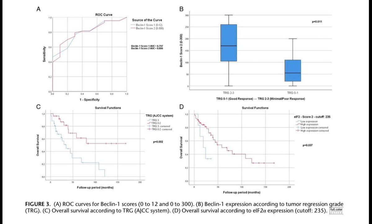 katcollmd's tweet photo. New article out now #AIMMhighlights 
▶️ Pretreatment biopsy IHC may help assess neoadjuvant response in rectal cancer
▶️ Higher Beclin-1 linked to poorer pathologic response and treatment resistance
▶️ Low eIF2α associated with shorter overall survival https://t.co/NbVm629LXd