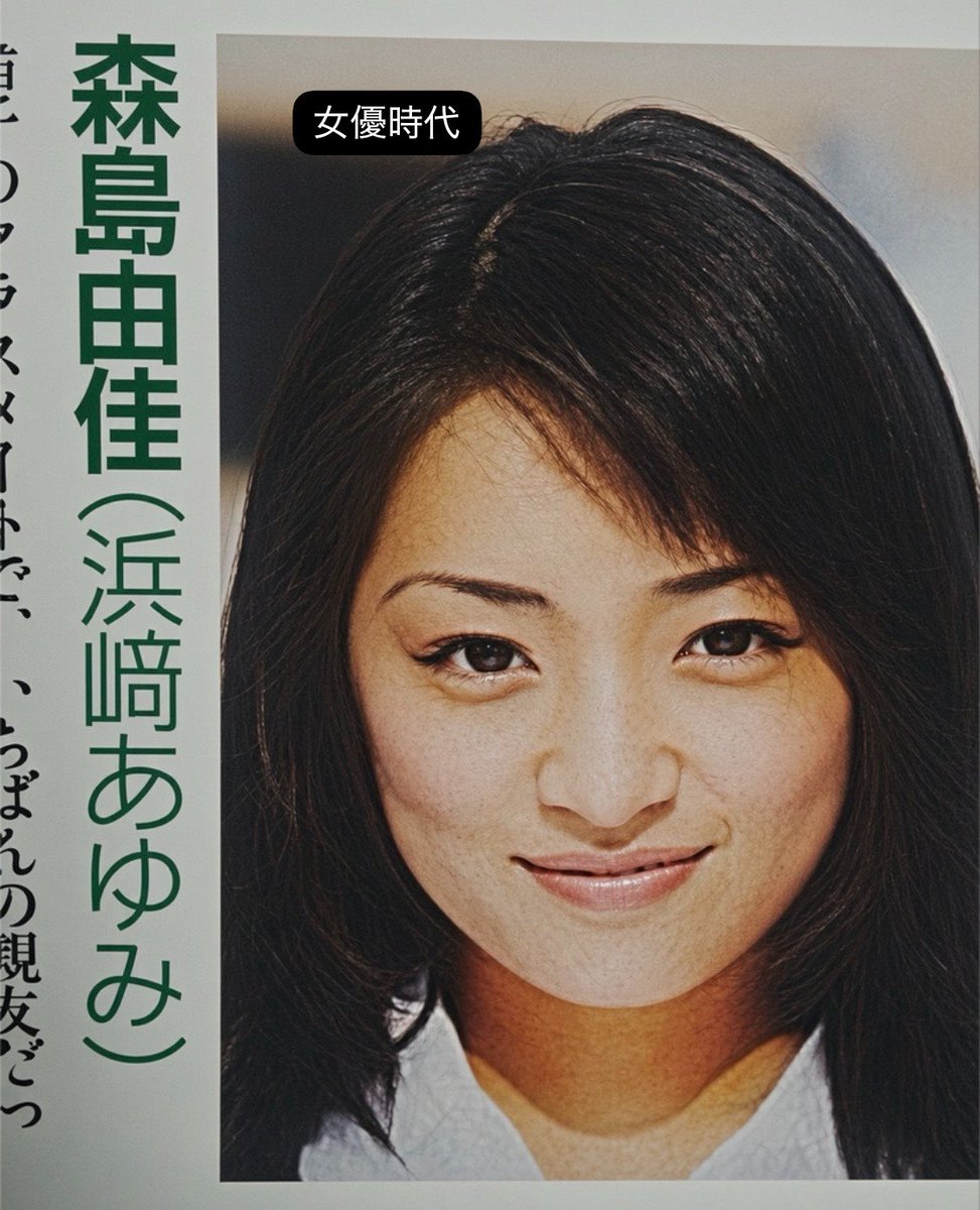 hmweum's tweet photo. 【悲報】浜崎あゆみさん、女性型AIロボ展示会の様な作画になる

頬脂肪吸引なのか、貴族プロテーゼなのか、全顔ヒアルロン酸なのかハムラ法なのかは分からないが、顔に謎の窪みが出ており皮膚も引き伸ばしたかの様にパンパンな張力を感じる。

コメント欄は"平子理沙"で大荒れになる。 https://t.co/xx4cF2ezcz