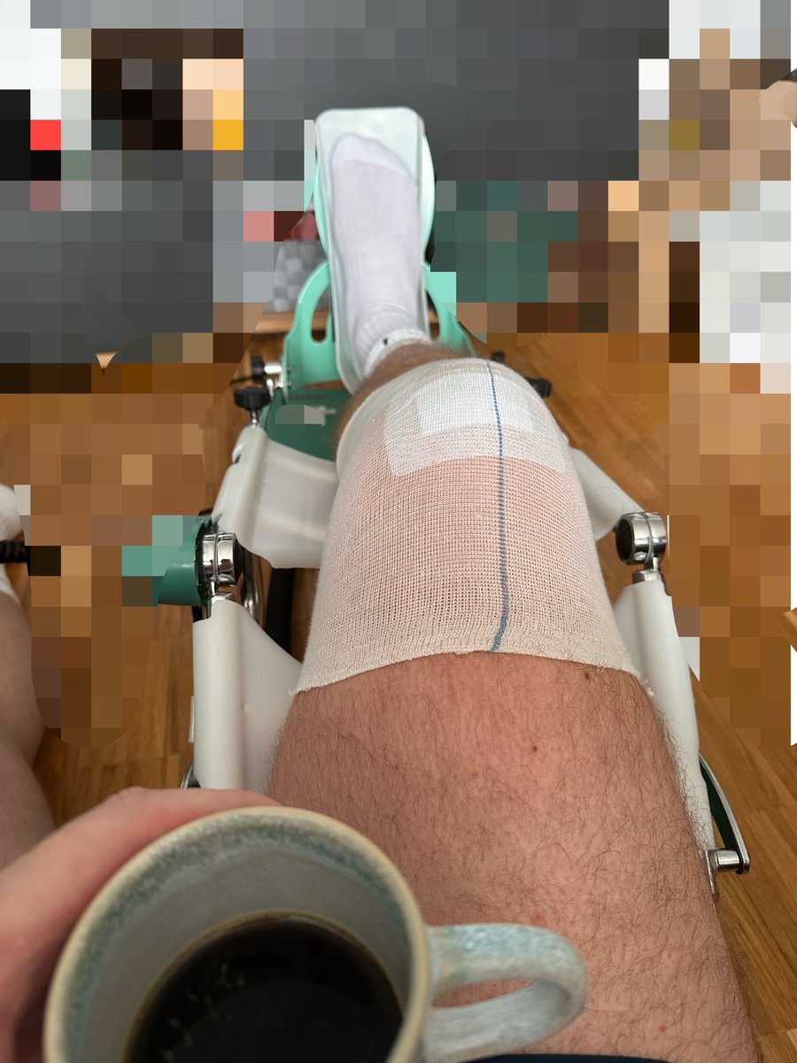 Mikemar9x's tweet photo. Muss ja wieder werden 🦿
#kaffeeundbeine #aclrehab #comeback #hilftjanichts https://t.co/jvWyB57jte