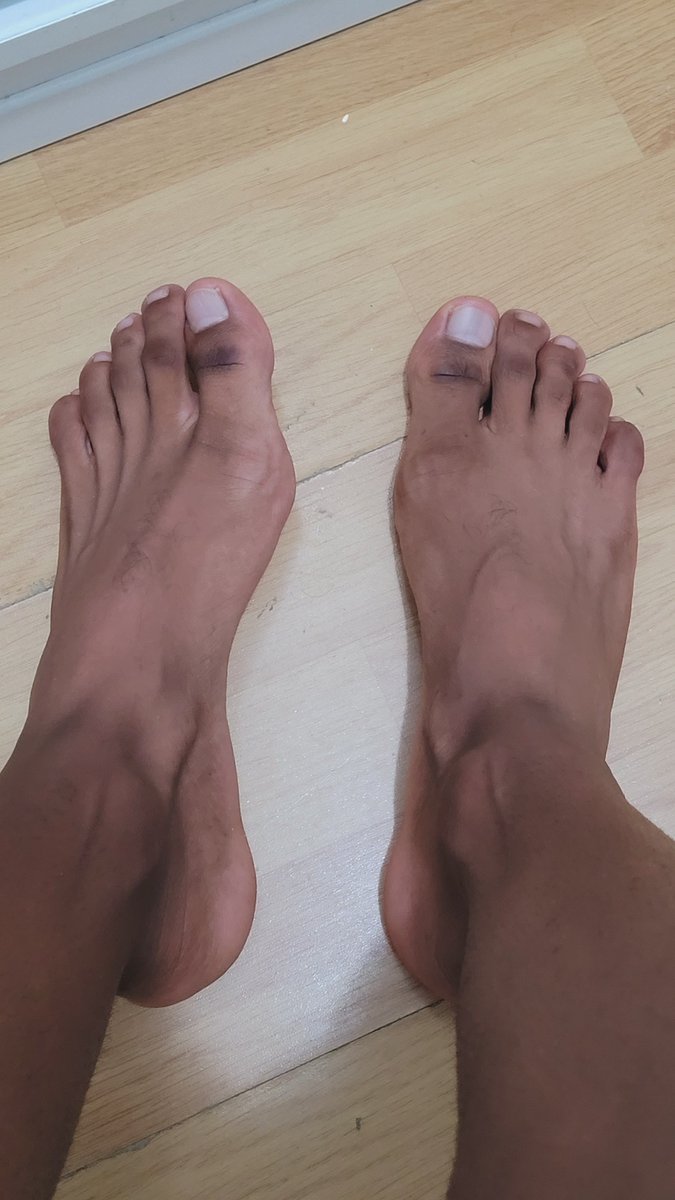 FabcampXXX's tweet photo. You guys prefer the tops? 👣
#malefeet #gayfeet #feetmale #gay https://t.co/vvvAB1E6IS