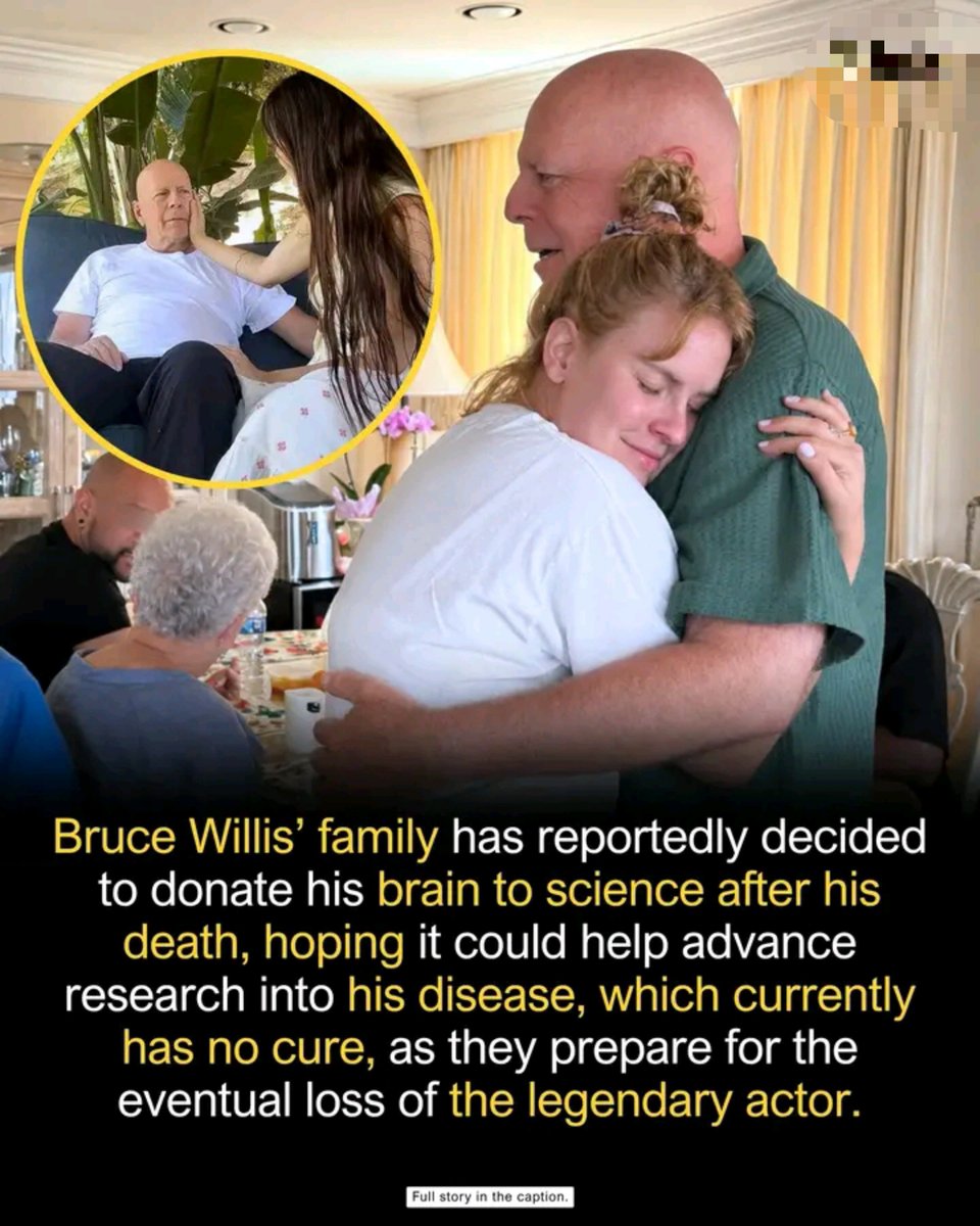 d_maniax's tweet photo. Bruce Willis spent decades saving the world on screen. Now, one of his most meaningful contributions could come after his lifetime.

The 71-year-old actor’s family has reportedly confirmed to donate his brain to science after his death, hoping researchers could learn more about frontotemporal dementia, or FTD, the incurable neurological disease he was diagnosed with in 2023. 

FTD damages areas of the brain involved in language, behavior, personality, and movement, and there is currently no cure or treatment that can stop its progression.

Donated brain tissue can give scientists a rare look at the microscopic changes caused by FTD, helping researchers better understand the disease and develop future diagnostic tools and treatments.

For a man who spent a career playing heroes, even the possibility of helping scientists fight an incurable disease would be a powerful final legacy.