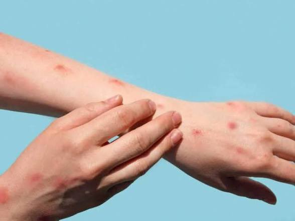 tumisole's tweet photo. #CountryDuty

The Department of Health has urged South Africans to exercise caution following a reported increase in #Mpox cases. 

An increase has been reported in Cape Town. https://t.co/yrQH5NT7T8