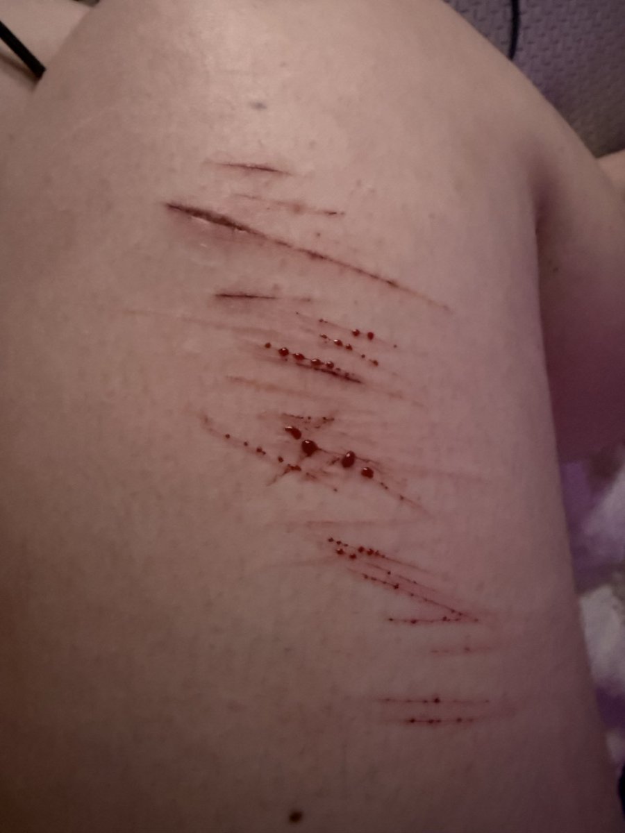 pherooha's tweet photo. i need hella tips on how to go deeper #catscratches #sh #selfharm #shtwtt #shtwt #twt ALL SFX https://t.co/cXtgwuyKDn