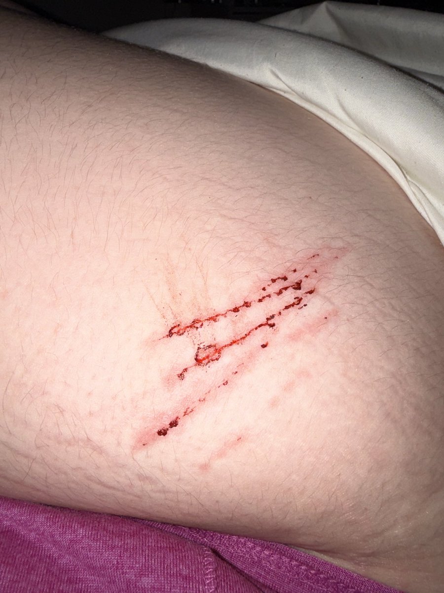 pherooha's tweet photo. i need hella tips on how to go deeper #catscratches #sh #selfharm #shtwtt #shtwt #twt ALL SFX https://t.co/cXtgwuyKDn
