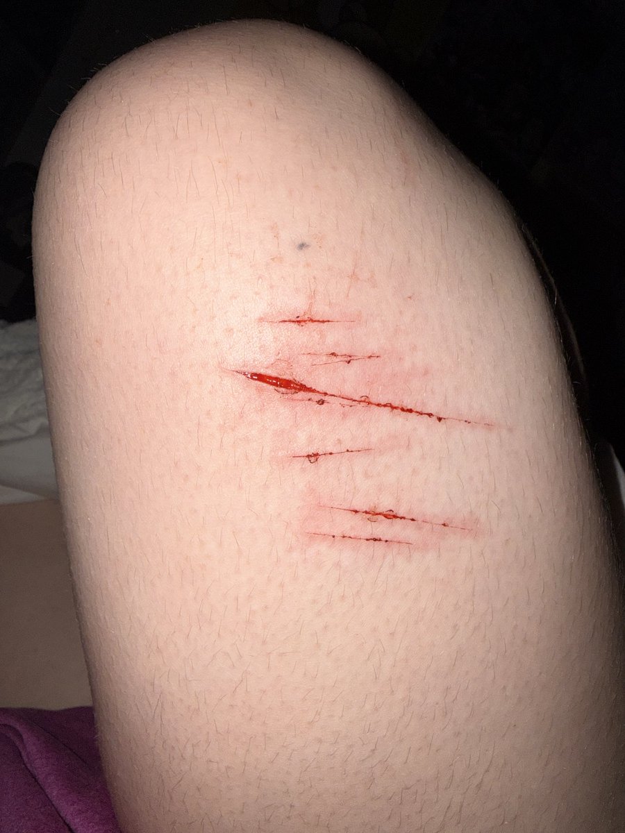 pherooha's tweet photo. i need hella tips on how to go deeper #catscratches #sh #selfharm #shtwtt #shtwt #twt ALL SFX https://t.co/cXtgwuyKDn