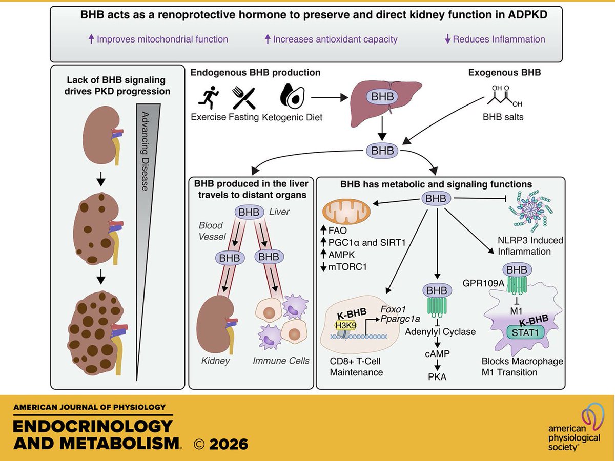 AJPEndoMetab's tweet photo. Review by @therealjacobt et al. (@weimbslab) β-Hydroxybutyrate: a renoprotective #hormone in polycystic #kidneydisease
https://t.co/UbF2pDugKN https://t.co/MbT0oDGBQU
