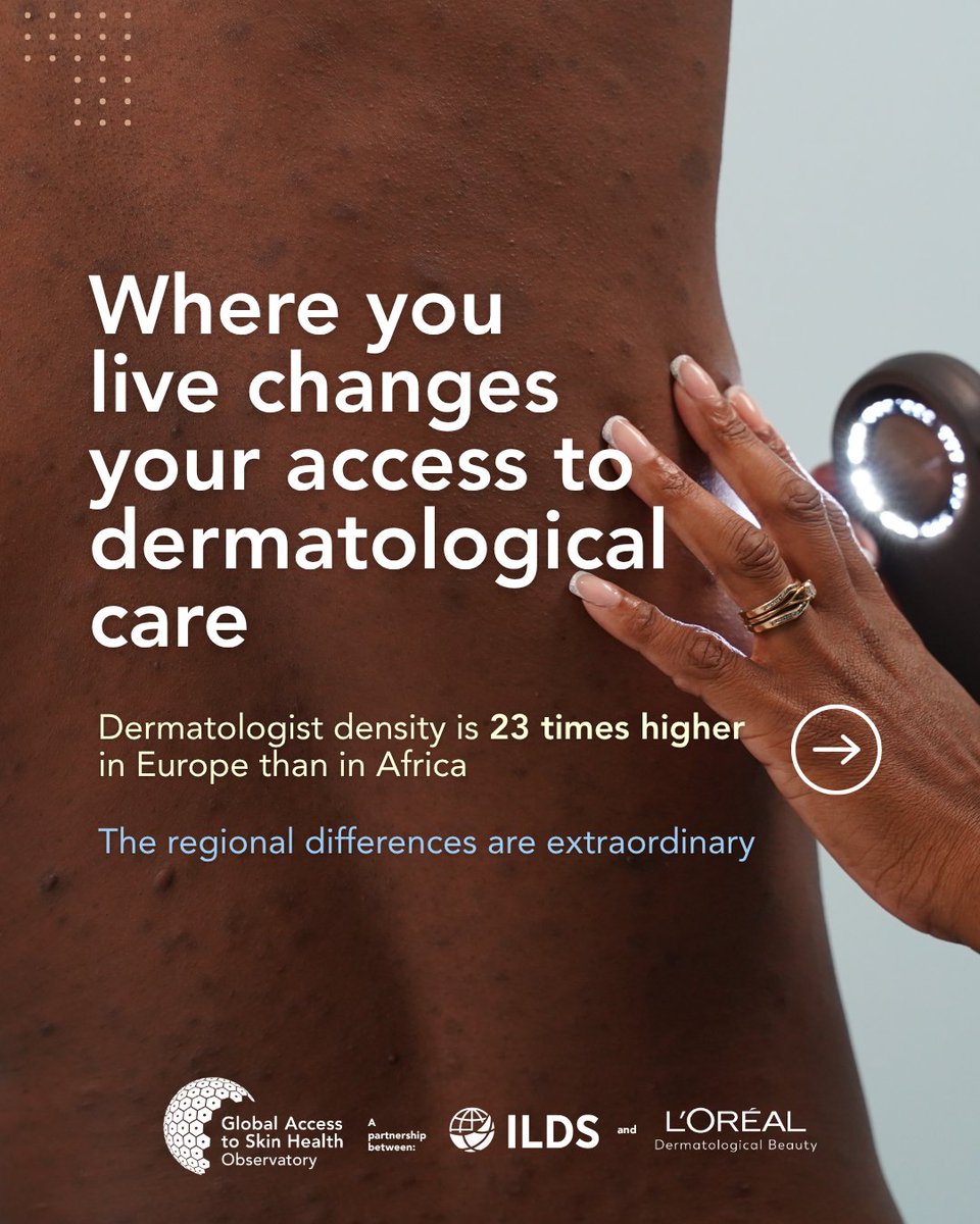 ILDSDerm's tweet photo. 📍 Where you live can shape your access to skin health care.

Africa has just 0.26 dermatologists per 100,000 people, compared with 6.0 in Europe. Addressing these workforce gaps is key to improving access to skin disease diagnosis and care worldwide.

🌍 https://t.co/niSdqiOFWP https://t.co/RQrnGUsrQF