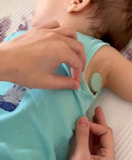 thatgirlessie_'s tweet photo. This morning I dropped my son off with the babysitter, and when I brought him home and gave him a shower, I saw something like this on his body, friends, what is this? Does anyone know? Please help.. https://t.co/TUSFneHxJ6