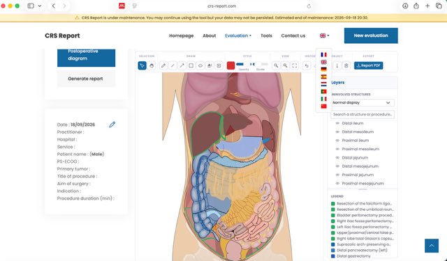 alotaibihaifa1's tweet photo. The Cytoreductive Surgery (CRS) Report Tool turns that mental reconstruction into an actual picture.

Map lesions, calculate the PCI score, highlight resections, document every resection and peritonectomy step by step, demonstrate the reconstruction, and generate a standardized report—all automatically, as you go.