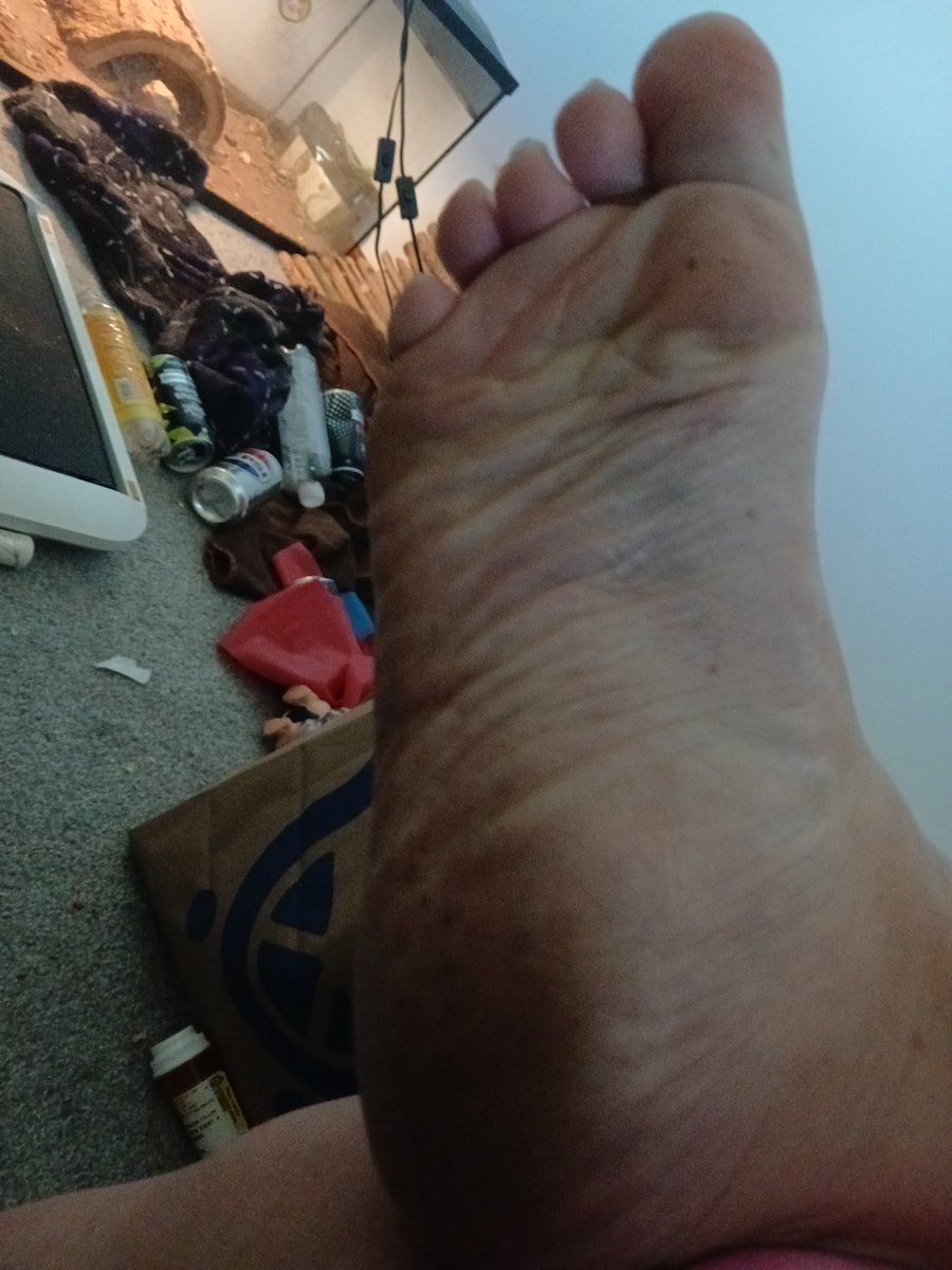 brat_kitty74's tweet photo. My cute little feet https://t.co/fLpGl2W0xR