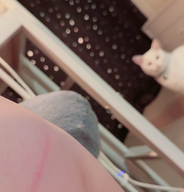 sbotokmr's tweet photo. DV受けてるんだよね実は https://t.co/CGDFgxYcuM