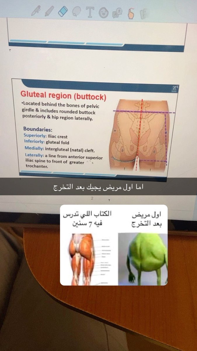 1jobest's tweet photo. اليوني لايف حقتي https://t.co/rjbVaxBFbM