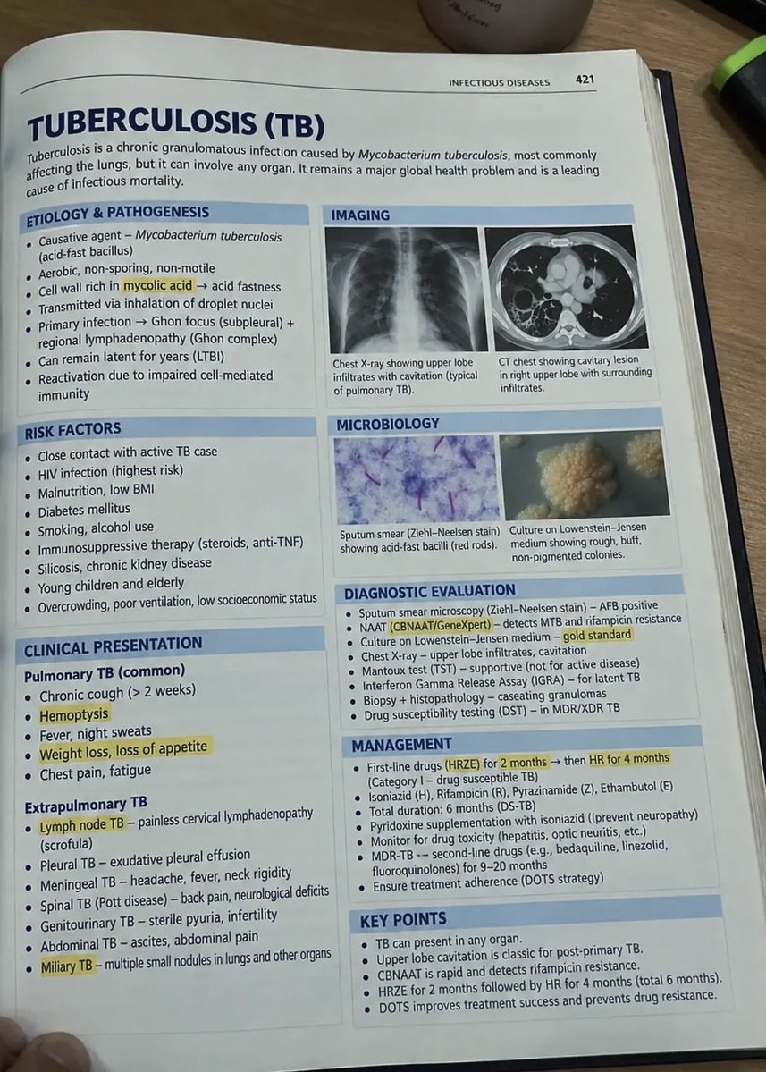 abdulhamid_199's tweet photo. صورة تختصر لك 
اهم المواضيع في الطب ( TB ) 

كيف تشخص وتعالجه

جدا مفيد 
احفظه عندك https://t.co/FTTlbGL2xe