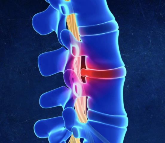 Tyler_Van_Acker's tweet photo. Less than 10% of back pain cases require treatment other than exercise.

But pain pills and spinal surgerry are being prescribed now more than ever.

From 7 years of physical therapy experience, here’s the 10 best exercises to avoid a lifetime of back pain: https://t.co/3WMaPlwwHb