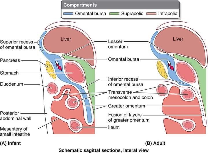 DrJonnys's tweet photo. The Peritoneum: not just a membrane, but architecture.
A single sheet that folds, fuses &amp; suspends to create:
🔵 Omental bursa &amp; its recesses
🟢 Supracolic compartment
🔴 Infracolic compartment, paracolic gutters &amp; pelvic pouches
Infant → Adult fusion tells the whole story. https://t.co/p5VS1OxHgk