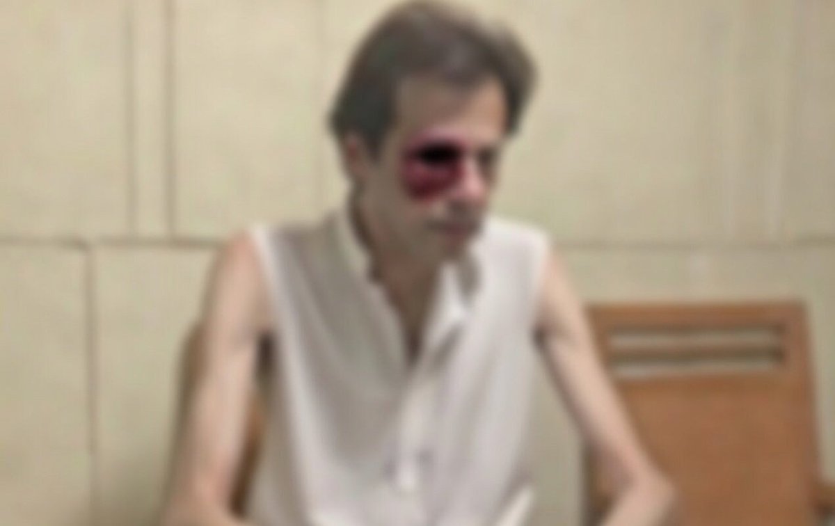 itsZimbuX's tweet photo. @ZacGoldsmith @BorisJohnson @ImranKhanPTI Imran Khan’s condition is reportedly very critical. Even Pakistani cricket fans aren’t standing up for him. Everyone is busy hyping an average player like Zim Babar. 😂

Imran Khan is rotting to d€ath. 🐐 https://t.co/k9v88KrCAw