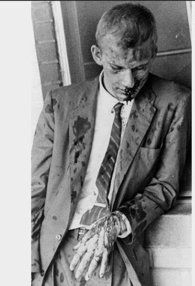 historical_Afr's tweet photo. Why is this white man relevant to Black history?  He was one of the Freedom Riders.  In 1960, he was on a bus full of Freedom Riders who arrived in Montgomery Alabama where an angry whitē mob was waiting for them. He volunteered to get off the bus first and take the brunt of the mob's viõlence, which left him beàten and blòody.  His name was James Zwerg.
