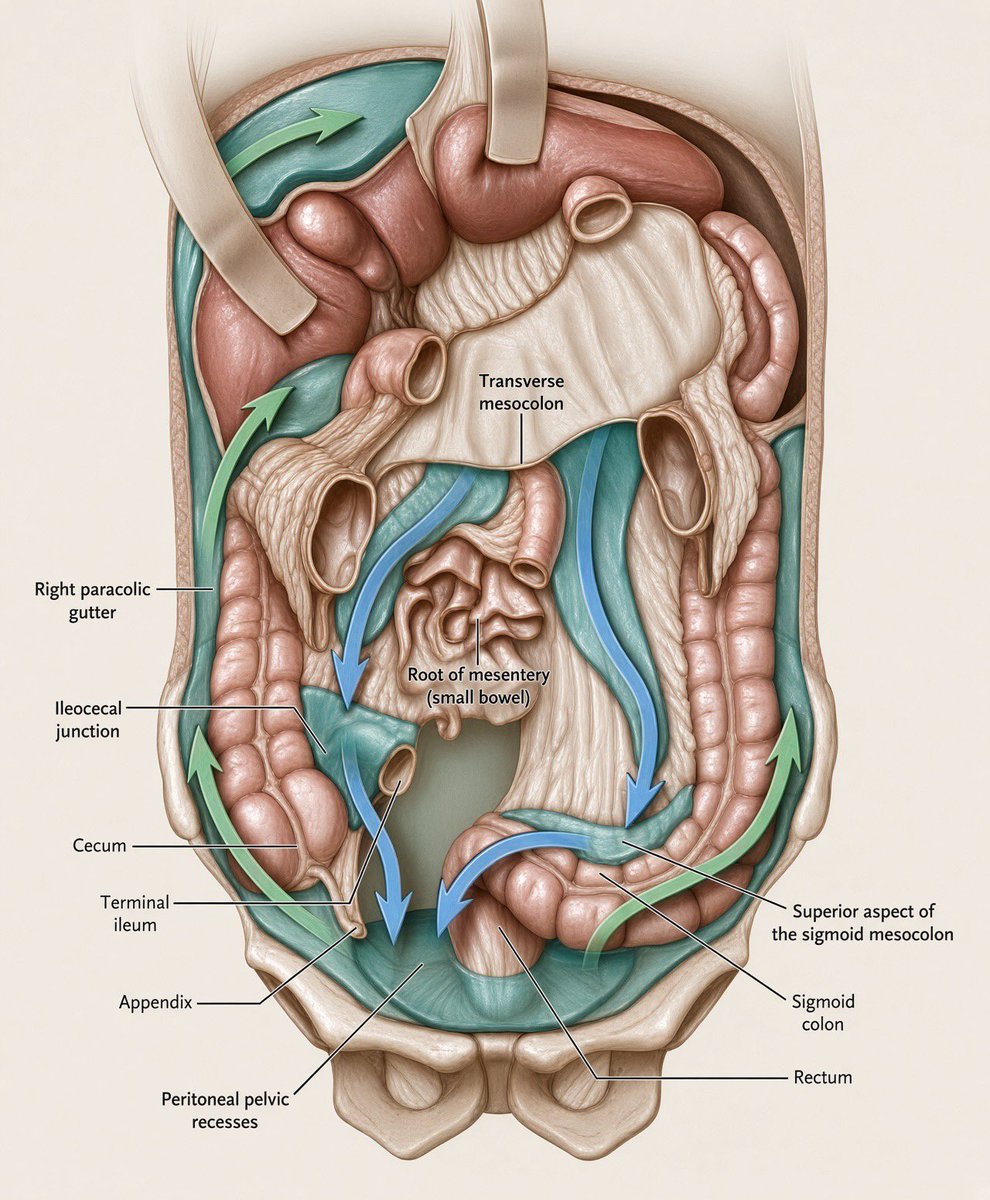 PipeCabreraV's tweet photo. Peritoneal fluid circulation ! @pferrada1 @SWexner @TomVargheseJr @CiruAndes2 https://t.co/HpLF9uV1Fx