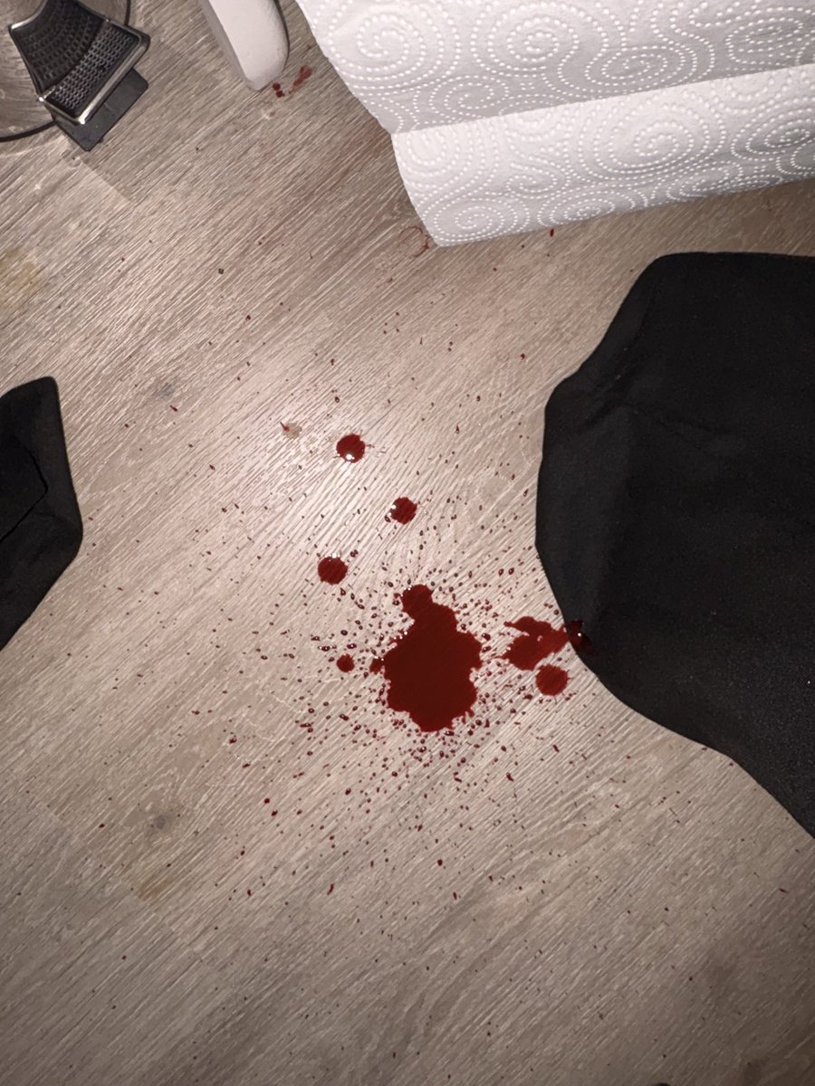 cloudyykittyy's tweet photo. #svwtw

its fale blood!!!  ALL SFXXX!!! https://t.co/jr6EiydoER